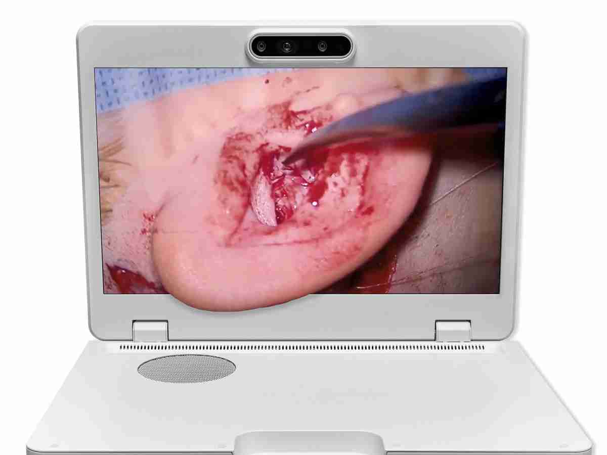 达擎之＂Heads-up 3D显微手术显示系统＂，，整合4K裸眼3D显示及眼球追踪系统，，，具备快速追踪人眼移动位置功能，，，，减轻医师长时间维持固定姿势的负担，，让医师能有更宽广清晰的3D立体视野及更舒适的姿势来执行手术。。。